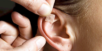 CURSO INTENSIVO DE AURICULOTERAPIA BÁSICA SEM AGULHAS